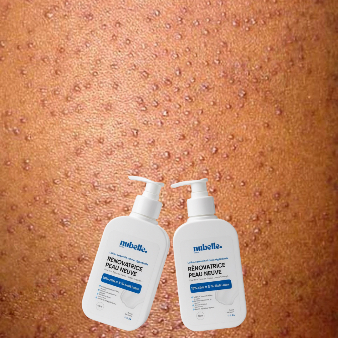 Peau neuve - Lotion corporelle rénovatrice